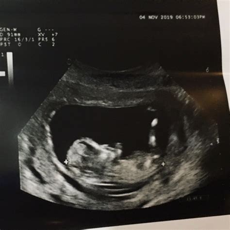 懷孕 12 週 生男 寶寶 特徵